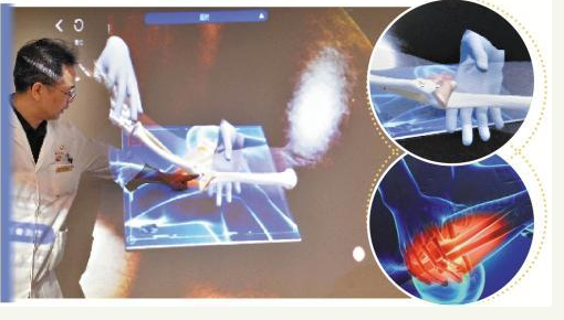 广州正骨医院利用AR技术重现传统正骨手法